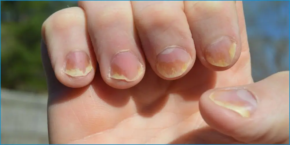 Maintaining Nail Health – YesTablets