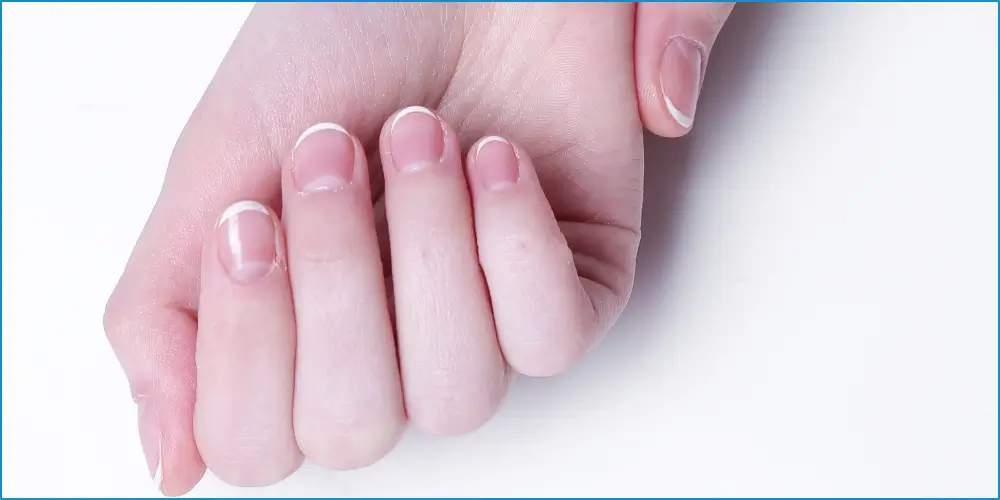 Unveiling the Causes of Herpes on Nails